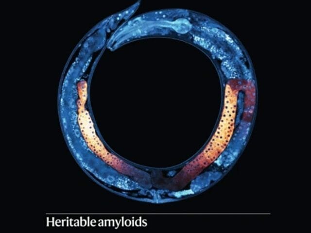 Traços hereditários podem ser transmitidos por proteínas do Alzheimer, diz estudo