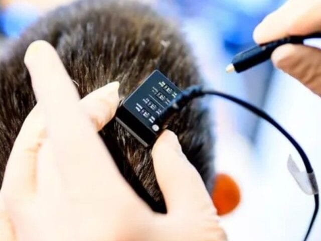 Implante no cérebro permite mulher ‘falar’ com seus pensamentos