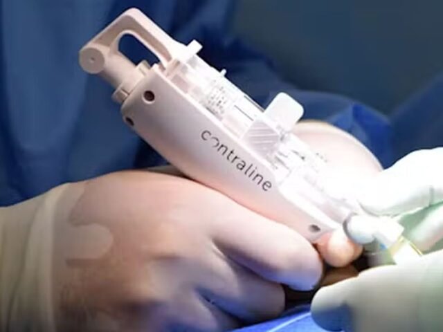 Anticoncepcional masculino tem resultados promissores e pode estar à venda em 2028