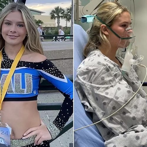 Líder de torcida desenvolve “pulmão de pipoca” após fumar vape por 3 anos