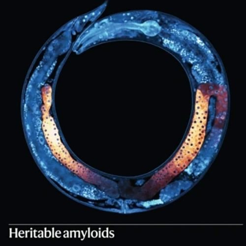 Traços hereditários podem ser transmitidos por proteínas do Alzheimer, diz estudo