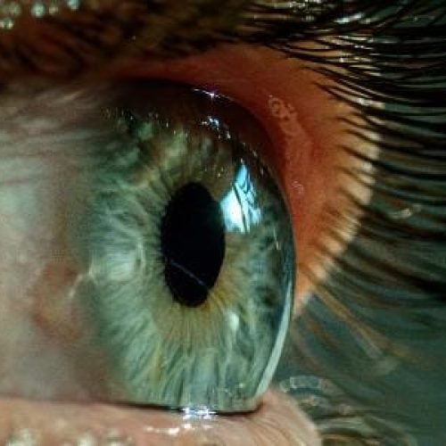 Governo mantém proibição de pagamento por ‘venda de íris’